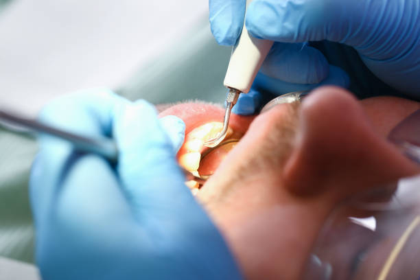 Best Emergency Denture Repair in Merrionette Park, IL