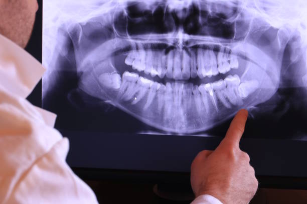 Best Urgent Care for Lost Fillings or Crowns in Merrionette Park, IL