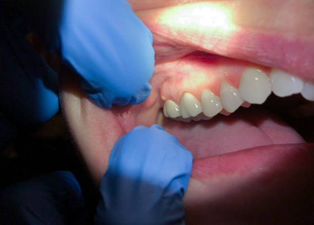 Best Emergency Denture Repair in Merrionette Park, IL
