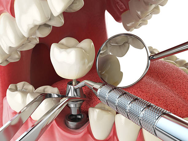 Best Cosmetic Emergency Dentistry in Merrionette Park, IL